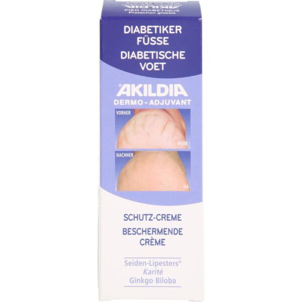 AKILDIA Fuß Schutzcreme für Diabetiker 75 ml